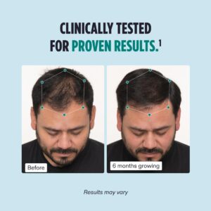 مکمل ریزش مو nutrafol نوترافول آقایان